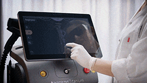 Soprano Titanium treatment interface being prepared by a clinician